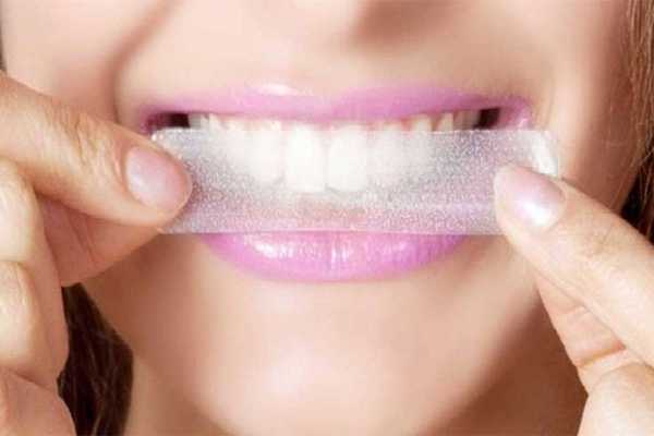 Hodnotenie najlepších prúžkov na bielenie zubov do roku 2020