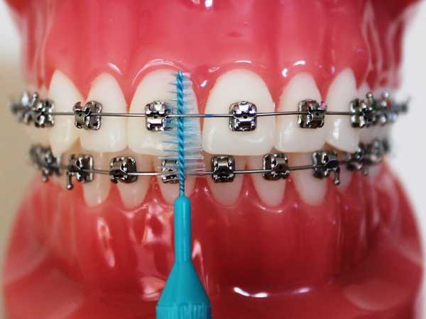 Hodnotenie najlepších zubných kefiek do roku 2020