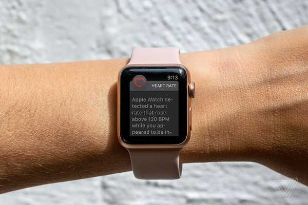 Chytré hodinky Hodinky Apple série 4 - výhody a nevýhody